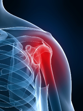 Shoulder pain